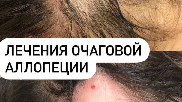 ტრიქოლოგ-კოსმეტოლოგი ბათუმი "კლინიკა ელიტა"