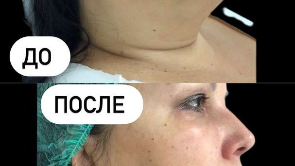 ტრიქოლოგ-კოსმეტოლოგი ბათუმი "კლინიკა ელიტა"