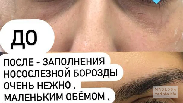 Фото до и после