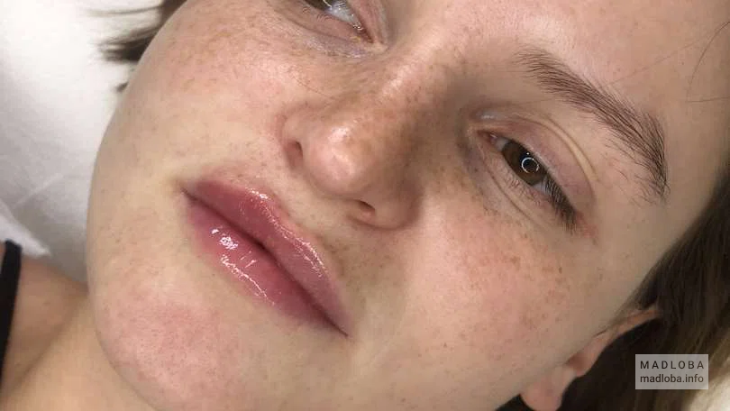 Уход за кожей лица