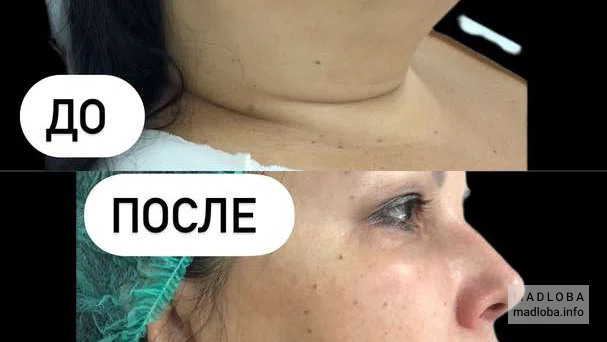 Фото до и после