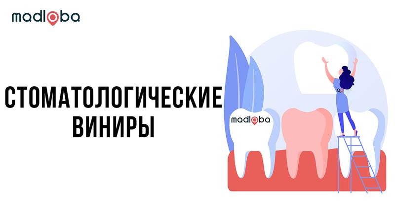 Стоматологические виниры в Грузии