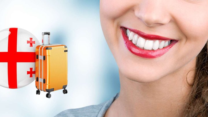 💎 Teeth in 2 weeks in Georgia: I tell you how I saved 3000 euros
