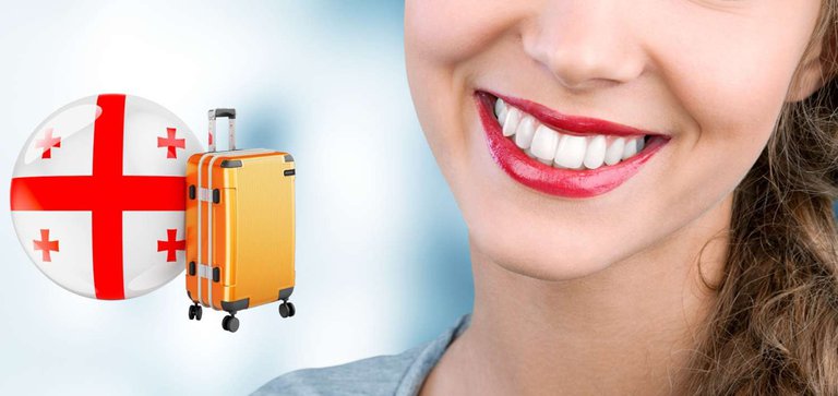 💎 Teeth in 2 weeks in Georgia: I tell you how I saved 3000 euros