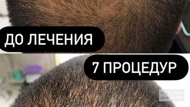Лечение волос
