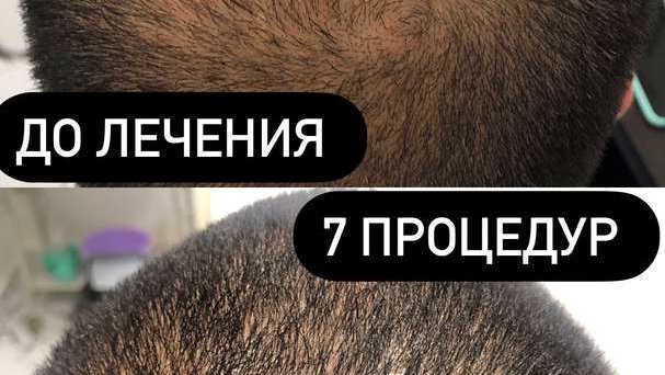 Трихолог-Косметолог Батуми