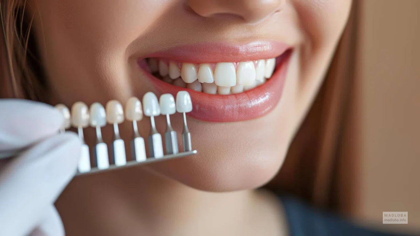 😁 SpartDental is the best dentistry in Kutaisi for a healthy and beautiful smile